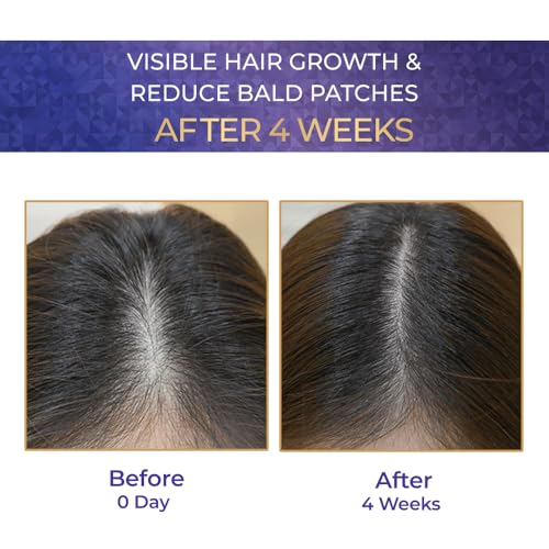 Image of Streax Hair Growth Serum for Scalp, 30 ml with 3% Redensyl, 3% Anagain, 3% Baicapil, Biotin & Caffeine, Hair Serum for Hair Fall Control, For Women & Men (Pack of 2)