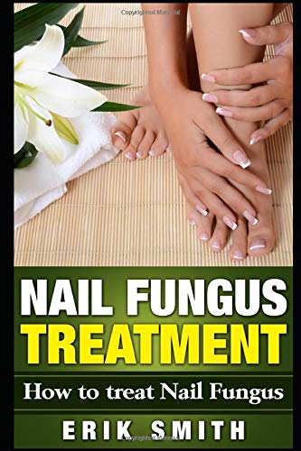 Nail fungus treatment: a beginners guide to nail fungus…