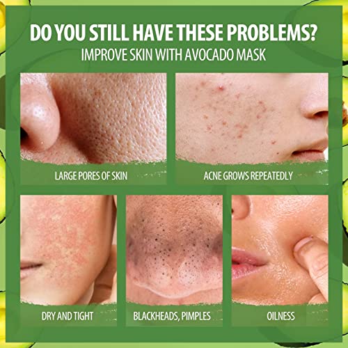 Clay Stick Mask Avocado Dead Sea Mud Mask Natural Green Tea Purifying Clay Stick Mask Deep Cleansing Blackhead Remover Clay Mask Nourishing Hydration Facial Mask With Blackhead Remover Extractor Tools #TOP2