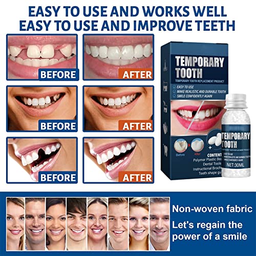 Wttfc Temporary Dentures, 2 Sätze Temporär Zahnreparatur Perlen mit Mundspiegel, Zahnsteinentferner, Zahnsonden, Zahnfleischreiniger, Thermal Klebend Perlen für Fehlende Gebrochene Zähne – Bild 5