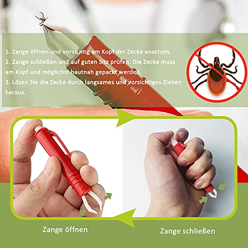 Nepfaivy Zeckenzange für Hunde Katze Kinder - 3er Set Zeckenhaken und 2er Set Zeckenpinzetten, Einfacher und Sicherer Zeckenentferner für Haustier und Menschen