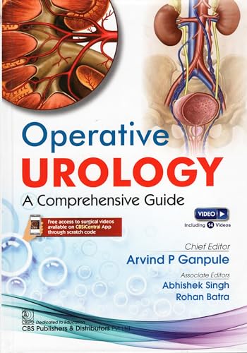 Image of Operative Urology A Comprehensive Guide (Hb 2025)