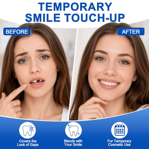 Image of Tooth Repair Kit, Moldable False Teeth Beads for Teeth Repair, Suitable for Missing, Cracked DIY Denture Kit, 1PCS-K1