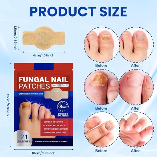 Image of Fungal Nail Repair Patches for Toenail & Fingernail Care - Hydrogel Nail Treatment Patches for Brittle, Thick and Discolored Nails | Overnight Adhesive Nail Care Strips, 10 Patches
