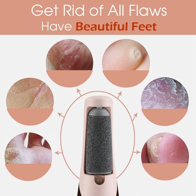 EXXELO Electronic Pedicure Tool Cordless Receable Calls Dead Skin Remover Polishing Wand With 2 Roller Heads EXXELO Electronic Pedicure Tool Cordless Receable Calls Dead Skin Remover Polishing Wand With 2 Roller Heads