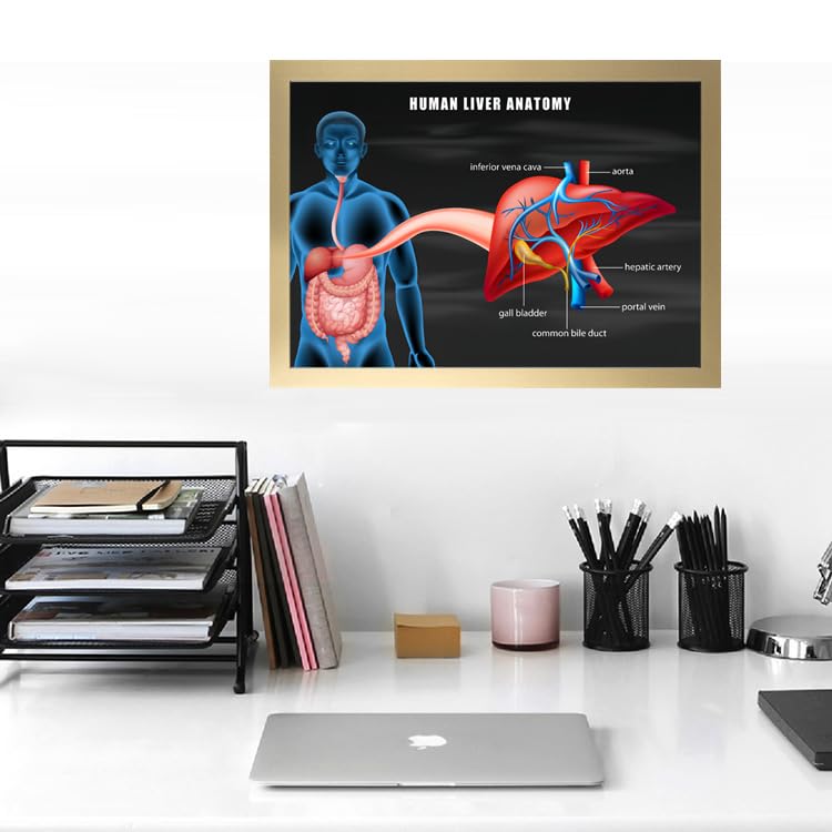 Image of Taanfu Body Educational Learning Anatomy Posters ，Liver Anatomy Art Liver Anatomy Villi Anatomy Art Poster Digestive System Organs Illustration Small Intestine Physiology Anatomy Wall Art Villi