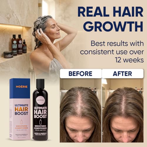 Image of Moerie Hair Growth Conditioner for Men and Women, Hair Loss Solution with Biotin and Rosemary, Thickening Conditioner for Thinning Hair - Ultimate Boost for All Hair Types
