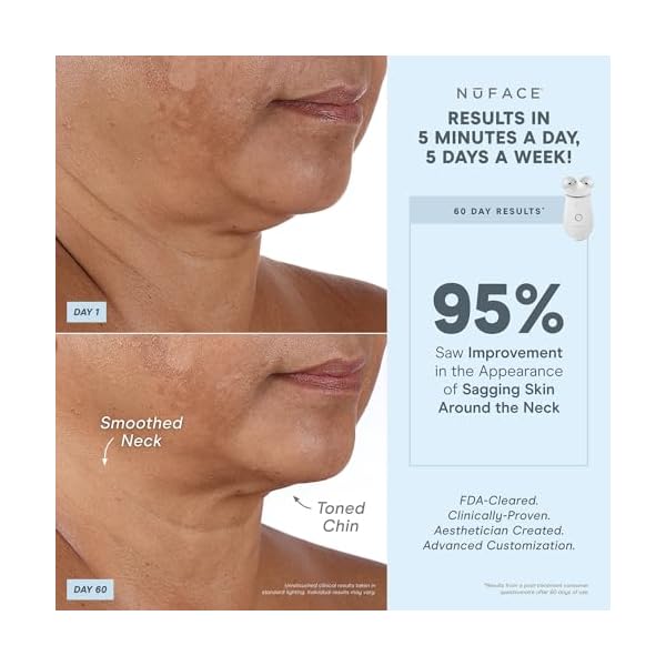 NuFACE TRINITY+ FDA Cleared Microcurrent Facial Device, Wrinkle Reducer + Effective Lip & Eye Attachment - Face Toning Device for Targeted Treatment + Microcurrent Gel Activator, Silk Crème & Brush - Image 3