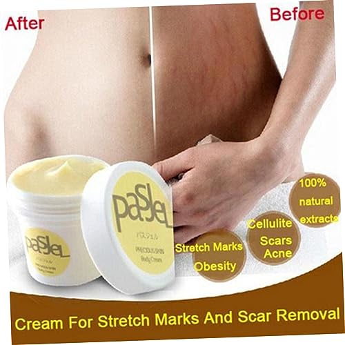 DOITOOL creme para estrias creme estrias Creme para eliminar estrias creme para cicatriz remoção de
