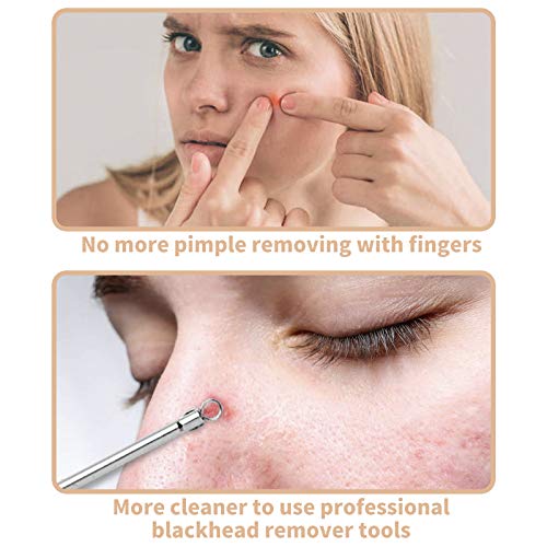 Top 10 Best blackhead remover pimple extractor acne comedone blemish