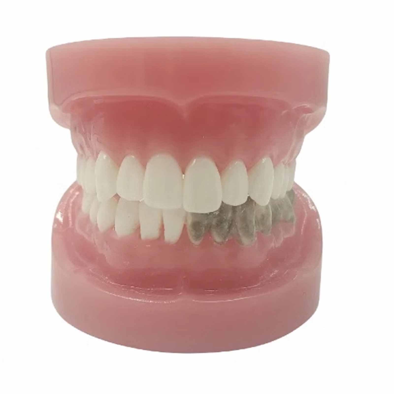 Model Zębów, Model Ekspozycyjny Z Nicią Dentystyczną, Do Nauki, Dla Dentystów, Studentów Stomatologii, Czysty Eksponat (Skóra 8 Cm),Flesh-8cm