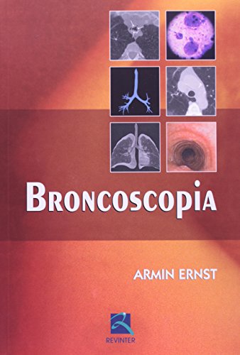 Broncoscopia