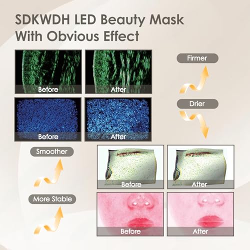 Sdkwdh SP-1103 Red Light Therapy Mask For Face, Led Face Mask Light Therapy At Home thumb #3