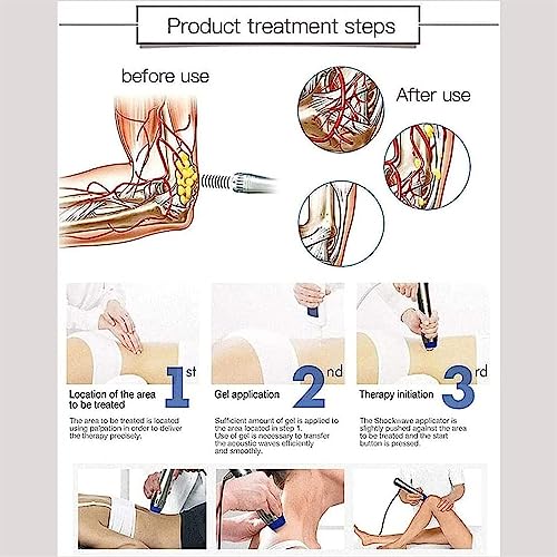 Máquina de terapia de ondas de choque extracorpórea, masajeador de tejido profundo muscular para disfunción eréctil y tratamiento ED, dispositivo de pulso electromagnético miniatura 4