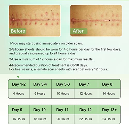 silicone scar sheets 16 x 120 roll-3m silicone scar tape roll scar silicone strips reusable professional scar removal sheets for c-section surgery burn keloid acne et