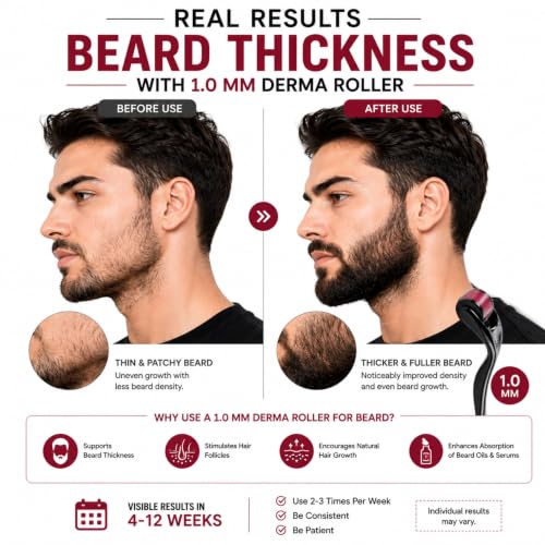 Image of Derma Roller for Hair and Beard Regrowth (1MM GuaSha Combo)