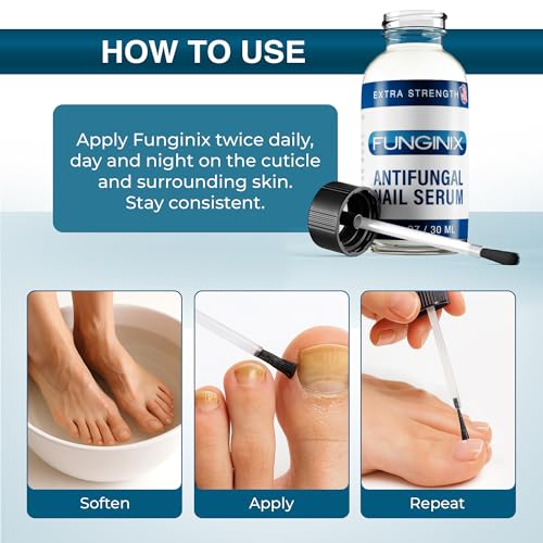 FUNGINIX Fungus Treatment - Toe Fungus, Finger Fungus, and Foot Fungus Solution Made In the USA - Extra...
