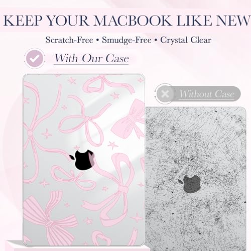 CeeVian Case Compatible with MacBook Air 13 inch M5 2026-2022 Release M4 M3 M2 A3449 A3240 A3113 A2681,Hard Shell Laptop Case with Keyboard Cover,Screen Protector & USB-C Adapter, Pink Bow Aesthetic by CeeVian - Used condition - Image 3