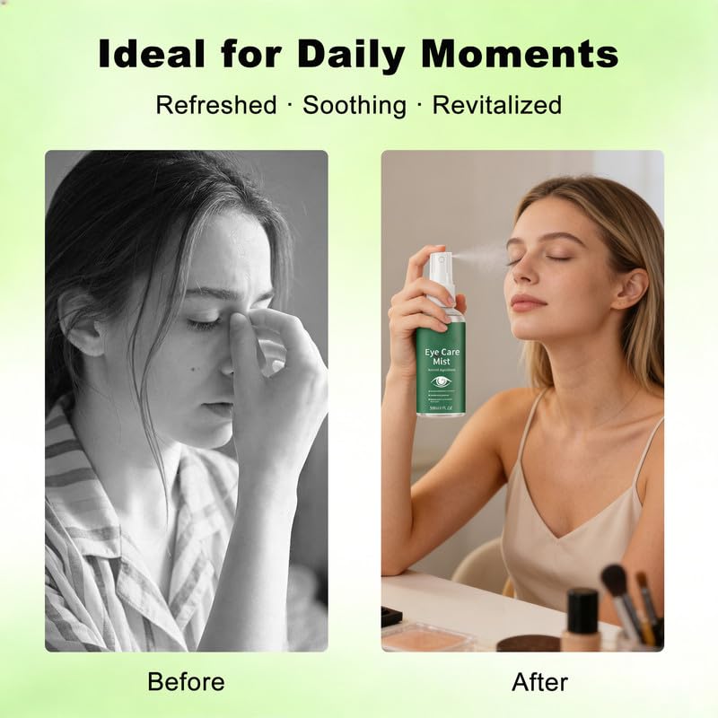 Hydrating Eye Mist Spray, 30 mL (1 fl oz) — Gentle Daily Comfort Mist for Dry, Tired-feeling Eyes — Lightweight, Fast-drying, Easy-to-use 2PCS