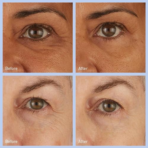 Skyn Iceland 8228904007 Hydro Cool Firming Under Eye Patches. Eye Gel Mask To Firm And Reduce Wrinkles thumb #2