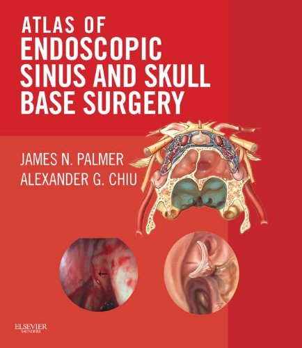 Atlas of Endoscopic Sinus and Skull Base Surgery: Expert Consult - Online and Print