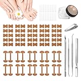 Professional Ingrown Toenail Corrector Set with Correction Strips – Complete Home Pedicure Kit for Men & Women, Non-Slip, Breathable, Pain-Free Relief