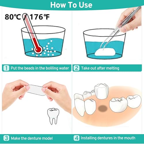 Image of Tooth Repair Kit with 4 Dental Tools, Temporary Tooth Replacement Set, Moldable Dental Fix