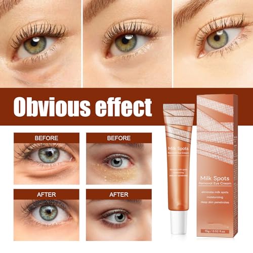 Milia Removal Eye Creams,Milia Spots Removal Eye Cream,Milia Remover,Firming Anti Wrinkle Whitening Eye Cream,Smooth Milia Eyes Cream,Milia Spot Care Cream,15g - Image 7