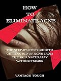  HOW TO ELIMINATE ACNE: The Step-By-Step Guide To Getting Rid Of Acne From The Skin Naturally Without Scars (English Edition)