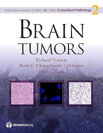 Brain Tumors: Consultant Pathology Series Brain Tumors: Consultant Pathology Series book cover