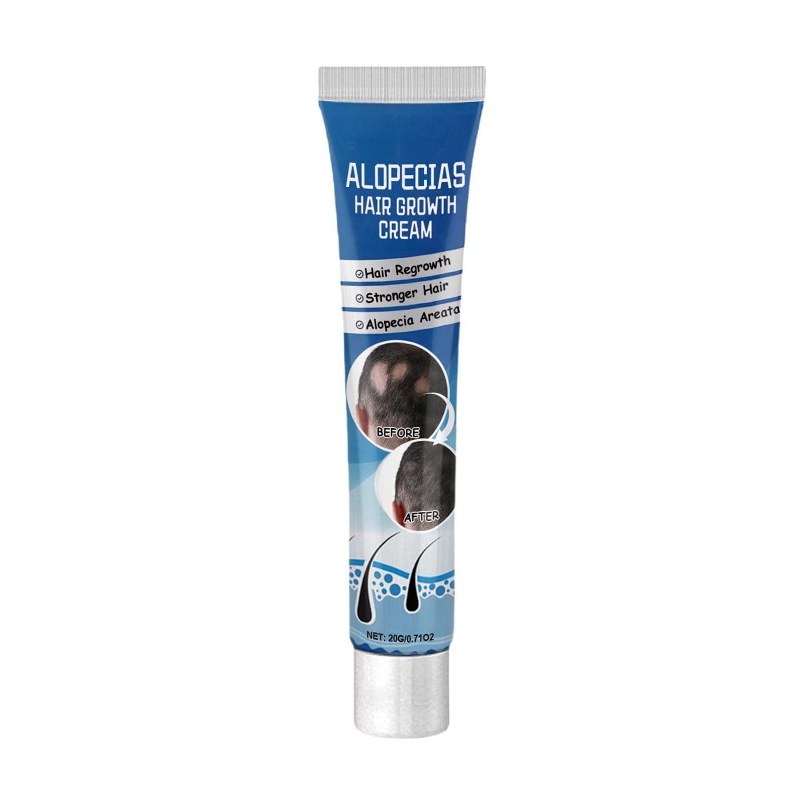 Alopecia Hair Growth Cream, Hair Growth Grease, Scalp Nourishing