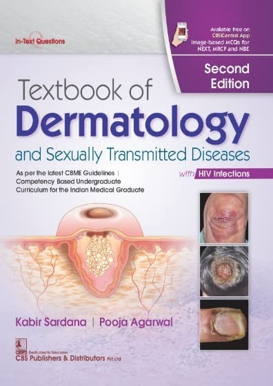 Textbook of Dermatology and Sexually Transmitted Diseases 2Ed.