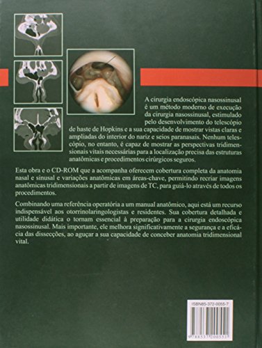 Cirurgia Endoscopica Nasossinusal: Anatomia, Reconstrução Tridimensional e Técnica Cirúrgica