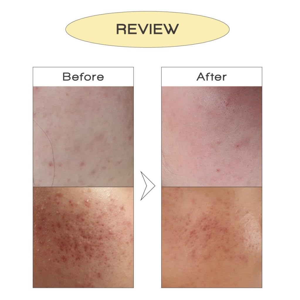 Korean Calming Balance Cream – Lightweight Soothing Gel Cream for Sensitive Skin, Natural Herbal Extracts, Deep Hydration & Redness Relief – 50ml (1.69 fl. oz.)