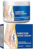 KOAHDE Crema Eliminación de Venas Varicosas,Crema Calmante Para Piernas,Alivio Rápido para Piernas Cansadas y Pesadas,60G,Relajación y Alivio de la Fatiga Mejora la Circulación Sanguínea