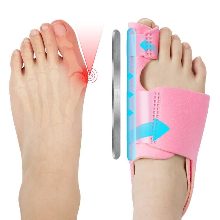 ACWOO Corrector de Juanete, Enderezador de Juanete Corrector Nocturno y Día, Férula para Juanete, Enderezador de Dedo con Ajustable, 2 Corrector de Juanete Hallux Valgu, 2 Separador Dedo Pie Silicon