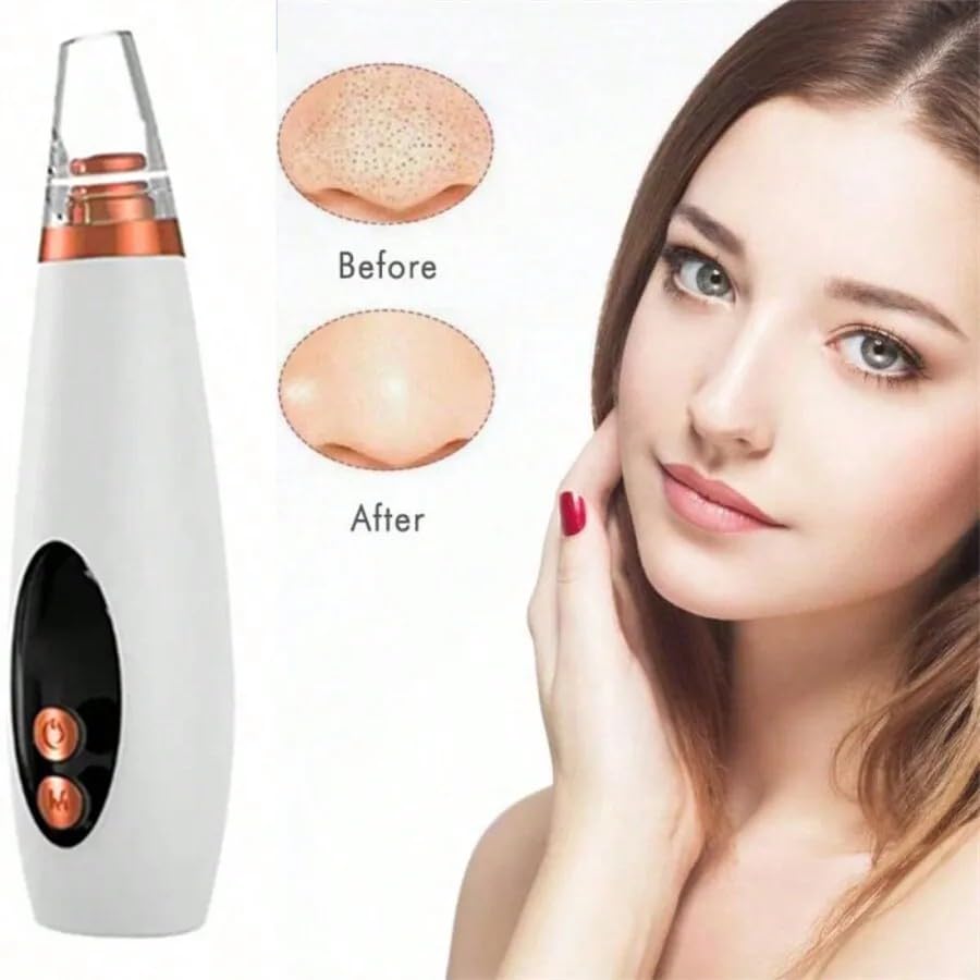Image of Flying Monk Blackhead Remover, USB Rechargeable Pore Vacuum, Comedone Extractor with Strong Suction, Facial Deep Cleansing Device for Oily Normal Dry Skin