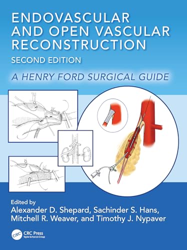 Endovascular and Open Vascular Reconstruction: A Henry Ford Surgical Guide (English Edition)