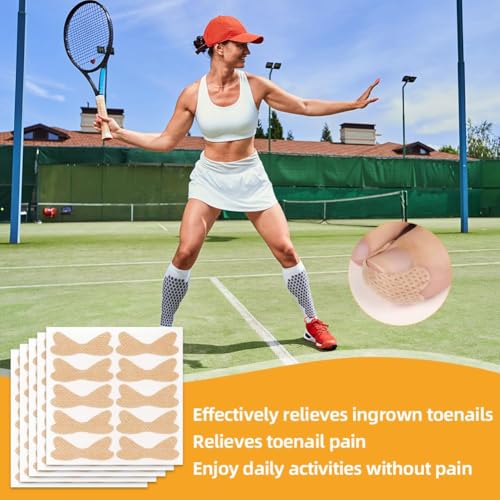 Image of 101 /190pcs Ingrown Toe Nail Remover, Toenail Corrector Strips and Ingrown Toenail Correction Tool, for Daily Nail Care and Post-Exercise Maintenance (190PCS Brown)