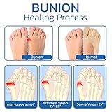 Zoom IMG-1 gliart orthoes calzini ortopedici per Zoom IMG-1 gliart orthoes calzini ortopedici per