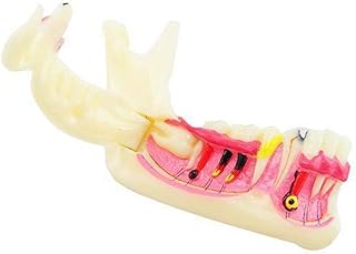 Teeth Teaching Model Pathological Tooth Model - Simulated Oral Teeth Right Mandibular Decomposition Oral Doctor-Patient Communication Model - for Study Display Teaching Medical Mo