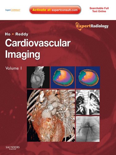 CARDIOVASCULAR IMAGING      1st Edition, Kindle Edition