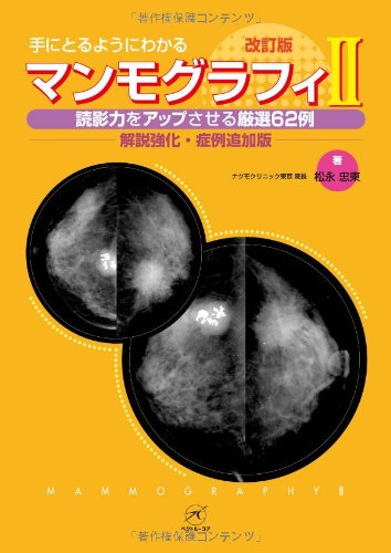 無料電子書籍 おすすめ マンモグラフィII 改訂版〜読影力をアップさせる厳選62例〜【解説強化・ バイ