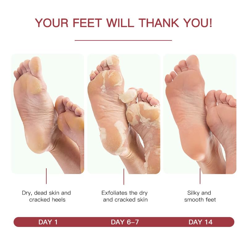 Exfoliating Foot Peel Mask for Soft Baby Feet 2 Pair Foot Mask Socks Repairs Rough Heels, Removes Dry, Dead Skin - Image 3