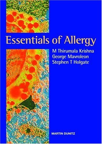 Essentials of Allergy Essentials of Allergy