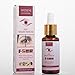 Styes Eye Relief Serum, 30ml Moisturize Blepharitis & Chalazion Remover, Gentle Under Eyelid Serum For Dark Circles, Puffiness.