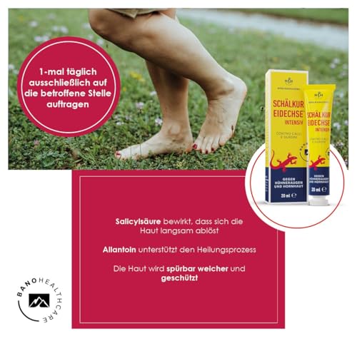 Eidechse Schälkur intensiv | Salbe gegen Schrunden, Schwielen, Hühneraugen und Hornhaut | enthält 40% Salicylsäure | Rösch und Handel