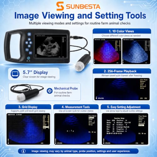 ultrasound machine premium 1709
