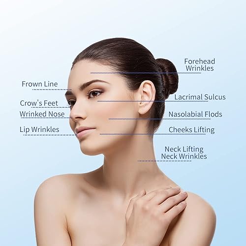 Miniatura 6 de Deenora Pdo - Hilos para estiramiento facial, rosca de tornillo Pdo tipo suave con punta afilada, suavizado de arrugas, 20 unidades (tornillo mono