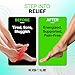 KiSole Acupressure Insoles – Reflexology Massage Shoe Inserts for Pain Relief & Energy Boost – All-Day Foot Support – Trim-to-Fit – Size S/M (US 5–10)